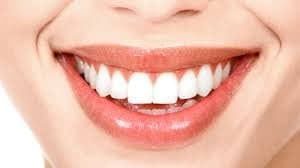 Imagen de referencia para diseño de sonrisa y odontología estética